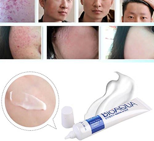 BIOAQUA 30g herbal anti acne face cream for blemish prone skin
