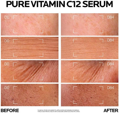 La Roche-Posay Pure Vitamin C12 Serum 30ml | SouqKingdom