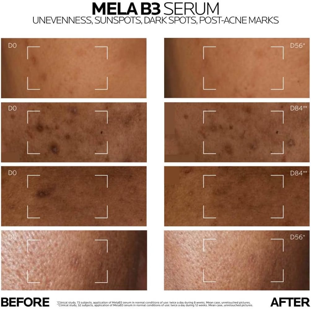 La Roche-Posay Mela B3 Dark Spot Corrector Serum 30ml Saudi Arabia
