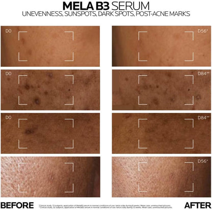 La Roche-Posay Mela B3 Dark Spot Corrector Serum 30ml Saudi Arabia