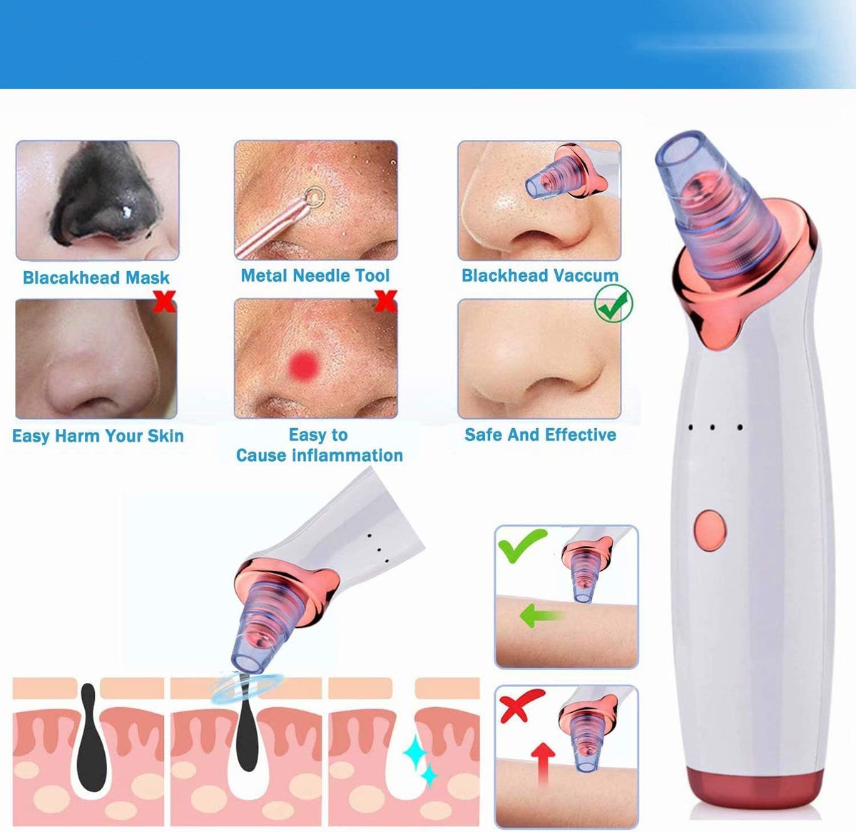5-in-1 Blackhead Remover Vacuum | Facial Pore Cleaner & Skin Care Device | USB Rechargeable | SouqKingdom Saudi Arabia