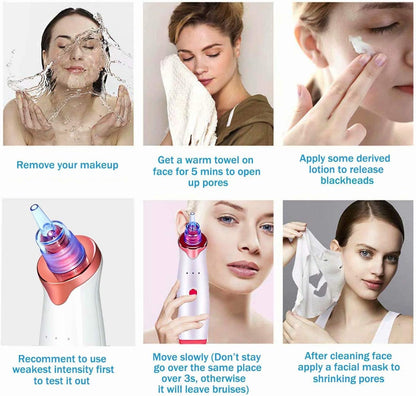 5-in-1 Blackhead Remover Vacuum | Facial Pore Cleaner & Skin Care Device | USB Rechargeable | SouqKingdom Saudi Arabia
