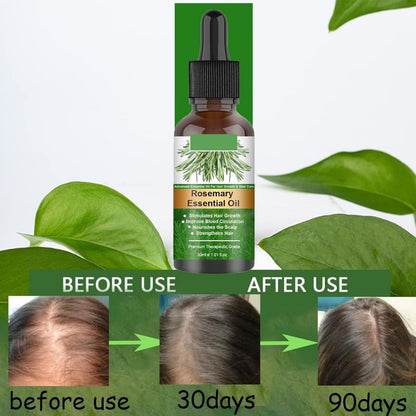 30ml Rosemary Hair Strengthening Oil SouqKingdom Saudi Arabia